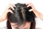 4 tác hại khôn lường với da đầu nếu bạn quên gội đầu sau mỗi lần tập luyện – Làm đẹp