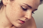 Tại sao phụ nữ hay nám da hơn đàn ông và cách xử lý cho làn da bớt nám như đàn ông – Làm đẹp