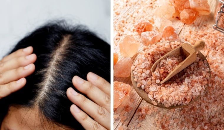 Mẹo dùng loại gia vị quen thuộc để gội đầu sạch gàu, giúp giảm tình trạng rụng tóc – Làm đẹp